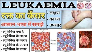Leukemia | Leukemia in hindi | Blood cancer | Symptoms of Leukemia | Treatment of Leukemia