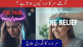 Instant Migraine relief at home | migraine relief hacks #headache #physiohub