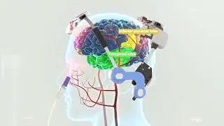 Neuro 3 | Brain PBM Visualization (Default Mode Network Stimulation)