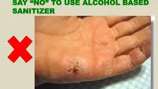 Universal Essence Herbal Hand Sanitizer