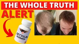 RESTOLIN REVIEW - Restolin Before And After - Restolin Complaints - Restolin William Anderson
