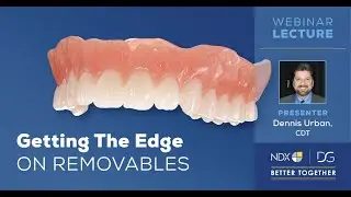 Getting The Edge On Removables