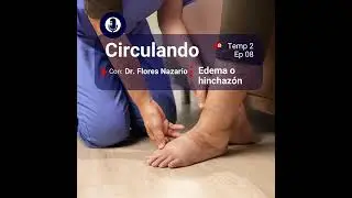 Piernas hinchadas y enfermedades vasculares: cómo identificar y tratar el edema. 🦵🔬 | Dr. Flores ...