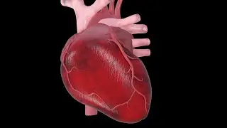Understanding Heart Disease and Heart Attack Risk | Preventive Cardiology