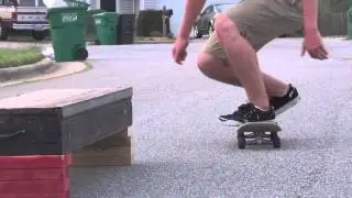 Zoomed In (Inward Heel Overwilly)