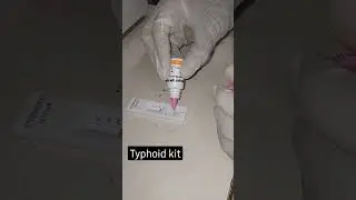 Typhi dot  [IgG & IgM] test procedure 🦠🦠