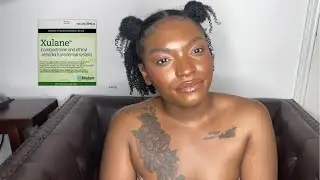 BIRTH CONTROL EXPERIENCE: XULANE DISCONTINUED???!!WHERE TO FIND IT!|BIRTH CONTROL UPDATE 2023
