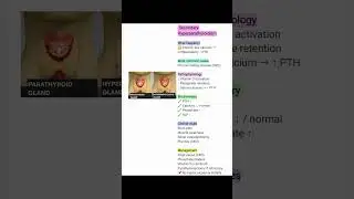 Secondary hyperparathyroidism made easy#medicaleducation #exampreparation#shortsfeed#generalsurgery 