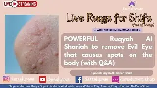 LIVE Ruqyah Al Shariah with Q&A to remove Evil Eye that causes spots on the body POWERFUL