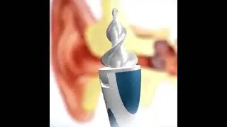 Smart Swab Ear Cleaner