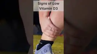 Signs and symptoms of Vitamin D3 deficiency, low vitamind in the body #shorts #viralshorts #diet