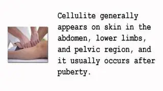 Cellulite Buster