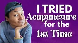 Trying Acupuncture For The First Time And Why I Liked It