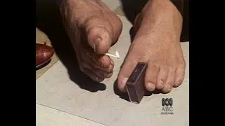 Brett Nielsen Performs Daily Tasks With His Feet (1978)