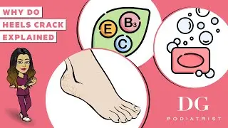 Why do heels crack? Cracked heels treatment series | The Foot Scraper: DG Podiatrist