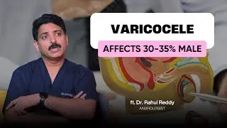 Varicocele Explained: Common Cause of Male Infertility