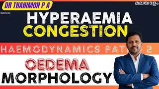 Hyperemia Congestion Pathology Malayalam Edema Morphology Malayalam Hemodynamic Pathology malayalam