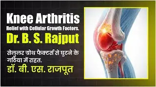 Severe Knee Arthritis Relief with Cellular Growth Factors | Dr. B. S. Rajput&rsquo;s Advanced Therapy
