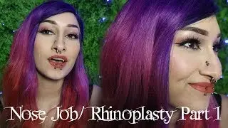 I GOT A NOSE JOB (RHINOPLASTY) + Why and Past Surgeries | Scream Kiwi