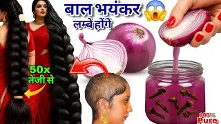 गंजेपन और हेयरफॉल का काल! 😱 DIY Onion Oil for 50x Hair Growth 💯 (बस 1 बार लगाओ)