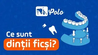 Dr. Polo - Ce sunt dinții ficși?