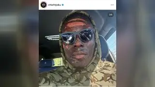 Browns&rsquo; David Njoku recalls how fire pit accident changed his perspective