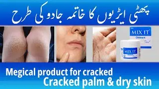 &ldquo;Dry Skin? Cracks Gone! 💯 | Mix It Healing Ointment&rdquo; #mixitointment #crackedskin #medicalskincare 