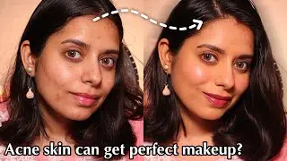 உங்களுக்கு Acne/Pimples இருக்கா? அப்போ இந்த Makeup Tutorial போதும் 👌 | Tamil Makeup Tutorial