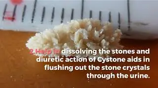 Cystone Syrup Benefits,How to Use,Side Effects Swasthyashopee