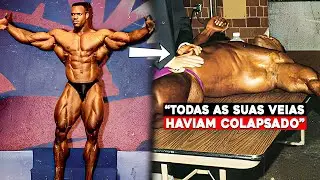 O que Aconteceu com Paul Dillett?!