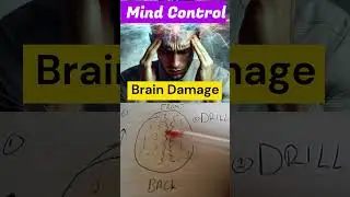 Targeted Individual - Mind Control means Brain Damage #chosenones #targetedindividual