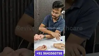 Silicone Hand I India's Best Silicone Restoration Hospital I +91 9643560798