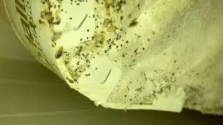 Bad Bed Bug Infestation in Montclair NJ