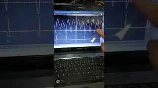 Kangoo le cambiaron buj&iacute;as y sigue la falla