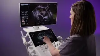 GE HealthCare Voluson Performance 18