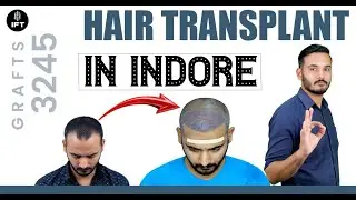 Hair Transplant in indore: Watch This First | IFT Hair Science