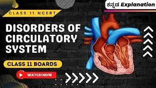 Disorders of circulatory system 07🔥 Body Fluids & Circulation Class 11