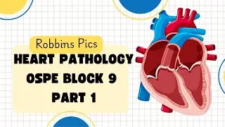 Heart Pathology Ospe part 1 &bull; Pathology Ospe block 9