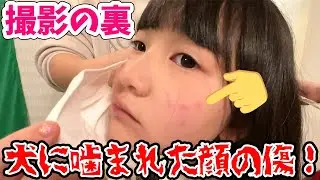 【MV撮影の裏】犬に噛まれた顔の傷が上手く隠せるかな？大変なクリスマスソングMV撮影の1日ルーティン【Vlog】 - はねまりチャンネル