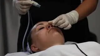 CoLaz Hydrafacial - Equivalent to 6 Facial in 1