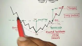 Topic -29 | Round Bottom Pattern | Saucer Pattern | Smile Pattern | Stock Market | Vikas Bopinwar