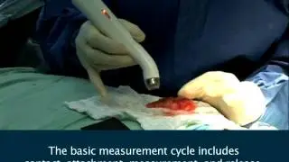 How to Use MarginProbe