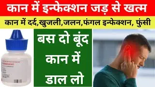 kan ka infection kaise theek karen/ear pain/ear pain medicine/Kan Dard Ki Dava/Candid ear drops used