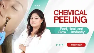 Chemical Peel Treatment | Acne Scars, Pigmentation & Skin Brightening | LaserTreat