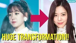 Apink Namjoo Plastic Surgery Becomes Viral News, Plan A Refused To Comment