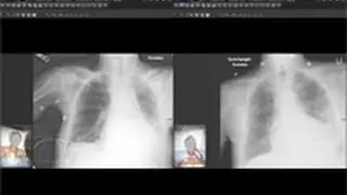 OTT: Video Tech Brief - System for Integrating Photographs with PACS