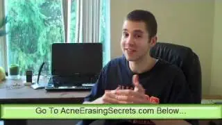 Sauna Acne Treatment