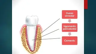 Periodonto de Inserci&oacute;n