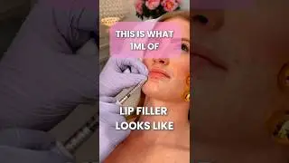 This is what 1ml of Lip Filler looks like! #lips #lipfiller #medspa #aesthetics #antiaging #face