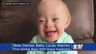 Next Gerber Baby Will Be A Boy With Down Syndrome